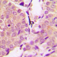 Anti-Alpha-synuclein (Phospho-Y133) Antibody