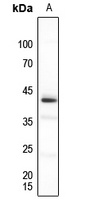 PU.1 Rabbit Polyclonal Antibody