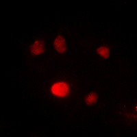 PU.1 Rabbit Polyclonal Antibody