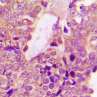 Anti-STAT2 Antibody