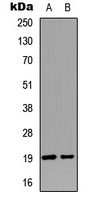 STMN1 (Phospho-S25) Antibody