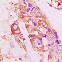 STMN1 (Phospho-S25) Antibody