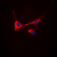 STMN1 (Phospho-S25) Antibody