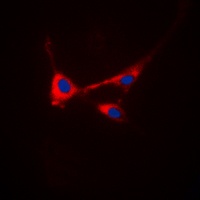 STMN1 (Phospho-S25) antibody