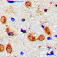 Anti-Synaptotagmin Antibody