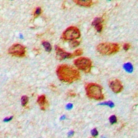 Anti-Tyrosine Hydroxylase (Phospho-S19) Antibody