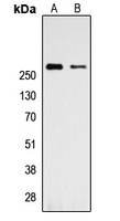 Talin 1 Rabbit Polyclonal Antibody