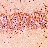Talin 1 Rabbit Polyclonal Antibody