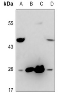 CD153 Rabbit Polyclonal Antibody