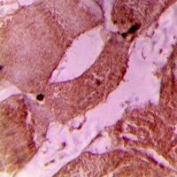 TNNI3 (Phospho-S22/S23) antibody