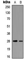 cTnI (Phospho-T142) Antibody