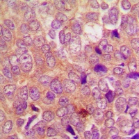Anti-UBR1 Antibody