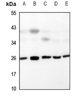 UBTD2 Antibody