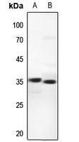 UCP3 Rabbit Polyclonal Antibody