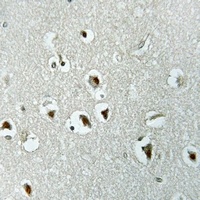 Anti-UTP14A Antibody