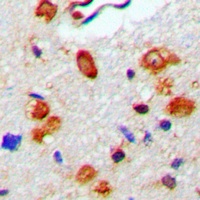 WASP (Phospho-Y290) Antibody