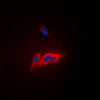 WASP (Phospho-Y290) Antibody
