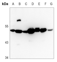 WWOX Rabbit Polyclonal Antibody