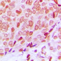 Anti-Ku70 (Phospho-S5) Antibody