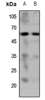 5-HT7 Rabbit Polyclonal Antibody