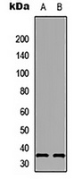 AANAT Rabbit Polyclonal Antibody