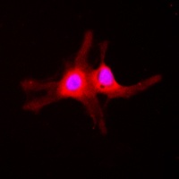 Anti-SGK1 (Phospho-S422) Antibody