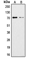 Ku70 (Acetyl-K542) Rabbit Polyclonal Antibody