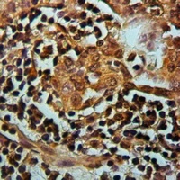 Ku70 (Acetyl-K542) Rabbit Polyclonal Antibody
