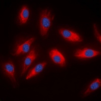 ACLY Antibody