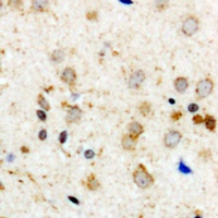 Anti-Aconitase 1 (Phospho-S711) Antibody