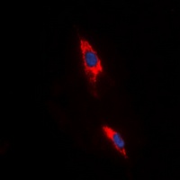 Anti-Adenosine A3 Receptor Antibody