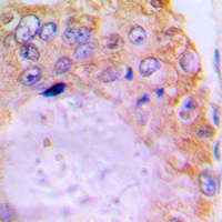 GRK2 Rabbit Polyclonal Antibody