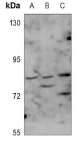 GRK2 Rabbit Polyclonal Antibody