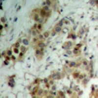 AKT1 (Phospho-T450) antibody