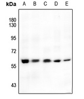 AKT (Phospho-S246) Antibody