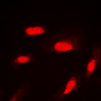 AKT1 (Phospho-S246) antibody