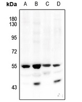 AKT1/2 (Phospho-T308/309) Antibody