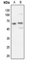 AKT Rabbit Polyclonal Antibody