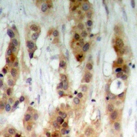 AKT Rabbit Polyclonal Antibody