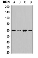 AKT Rabbit Polyclonal Antibody