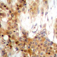 AKT Rabbit Polyclonal Antibody
