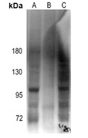 Androgen Receptor (Phospho-S213) Antibody