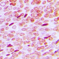 Anti-Androgen Receptor (Phospho-S213) Antibody