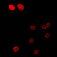 AR (Phospho-S213) antibody