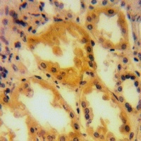 Anti-A-RAF Antibody