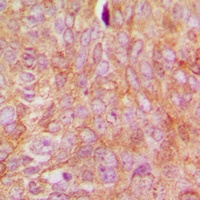 Anti-RhoGDI alpha (Phospho-S174) Antibody