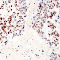 ATF2 (Phospho-S62) antibody