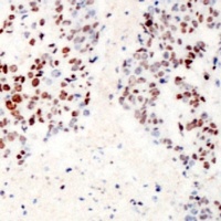 Anti-ATF2 (Phospho-S62) Antibody