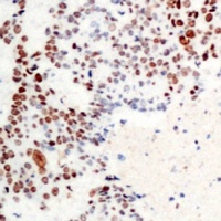 Anti-ATF2 (Phospho-T71) Antibody