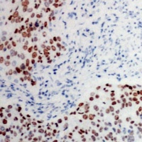 Anti-ATF2 (Phospho-T73) Antibody
